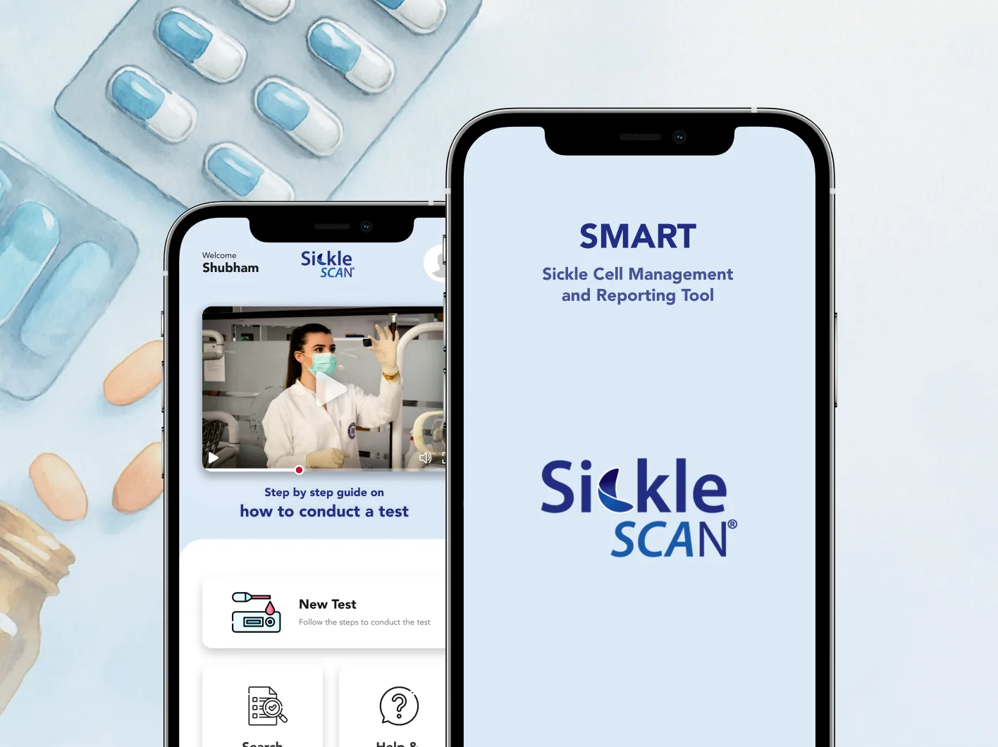 Sickle SCAN showcase